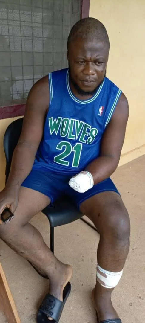 Fear Grips Yagba Communities as Kidnappers Maim Victims
